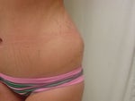 dog ear after